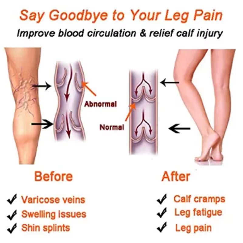 Women Compression Socks Slimmi - Echinacea review and price