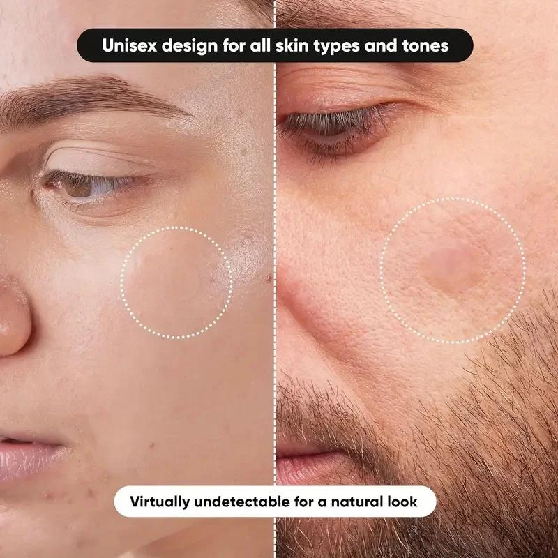 360 pieces/box acne patches -  - Essential Oils review and price